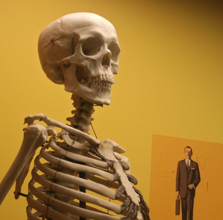 human skull, with briefcase